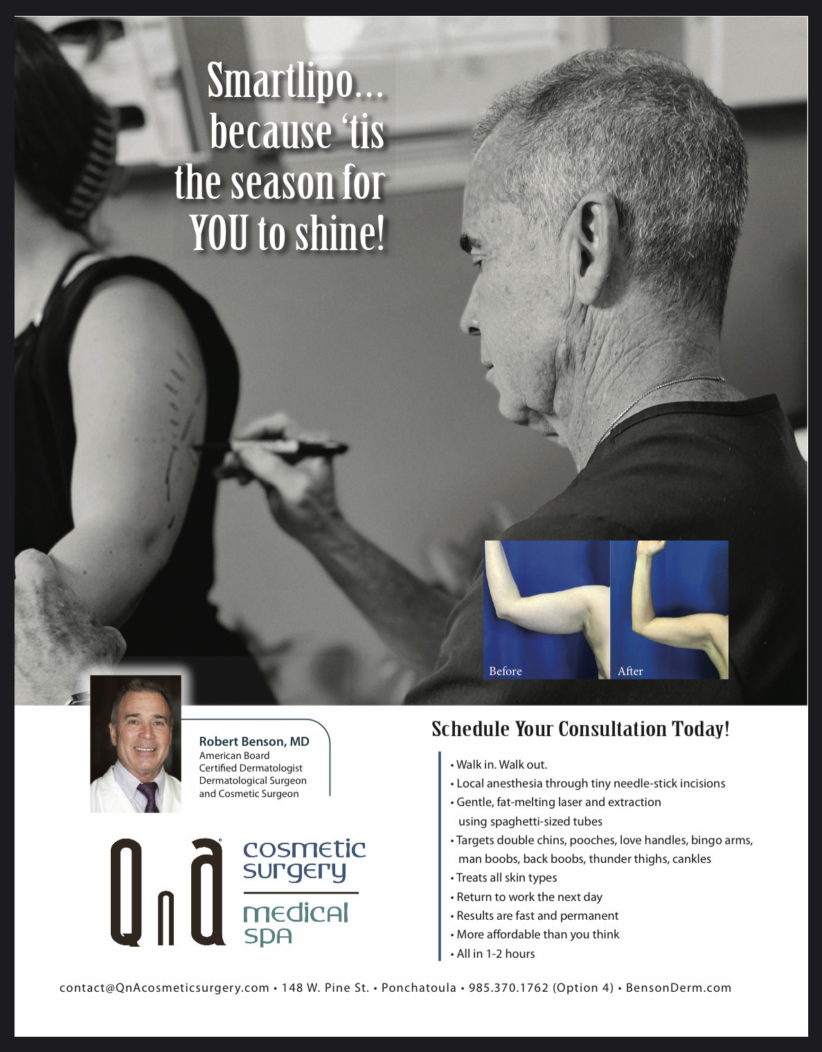 Smartlipo Special